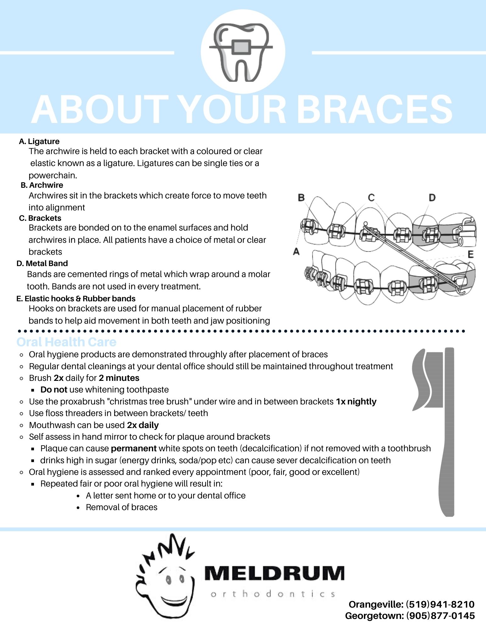 About your Braces